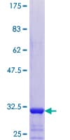 Human TMSB4Y Protein (Recombinant GST)