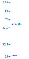 Human CELA2A / ELA2A Protein (Recombinant GST)
