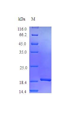 Mouse IL11 Protein (Recombinant)