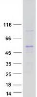 Human LASS3 Protein (Recombinant Myc-DDK (Flag))
