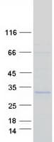 Human NFYB Protein (Recombinant Myc-DDK (Flag))