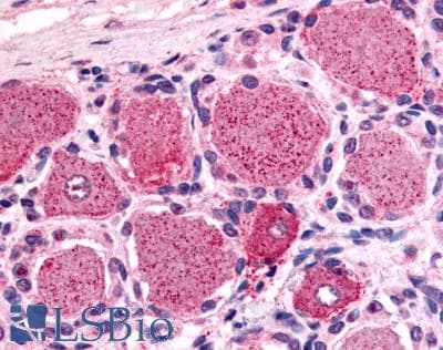 IHC-plus™ Polyclonal Rabbit anti-Human HTR1D / 5-HT1D Receptor Antibody (Cytoplasmic Domain, IHC)