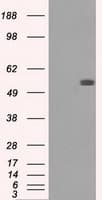 Monoclonal Mouse anti-Human FH / Fumarase / MCL Antibody (clone OTI2A2, IF, WB)
