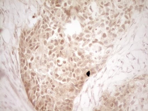 Monoclonal Mouse anti-Human PRTN3 / Myeloblastin Antibody (clone 5B8, Carrier-free, aa28-248, IHC)