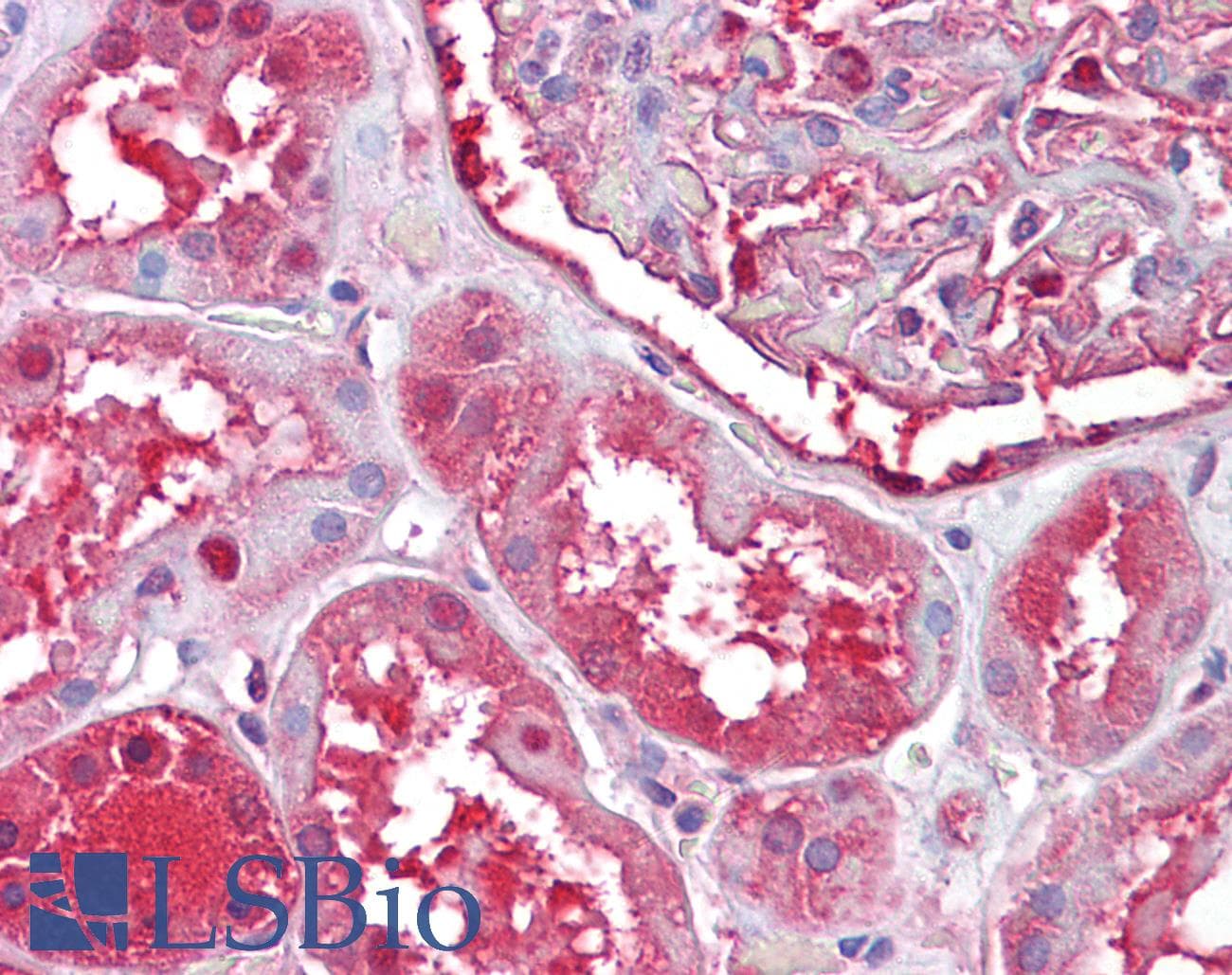 IHC-plus™ Monoclonal Mouse anti-Human PRDX6 / Peroxiredoxin 6 Antibody (clone 4A3, IHC, WB)