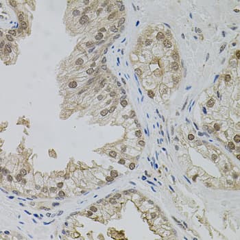 Polyclonal Rabbit anti-Human MAPK1 / ERK2 Antibody (IHC, WB)