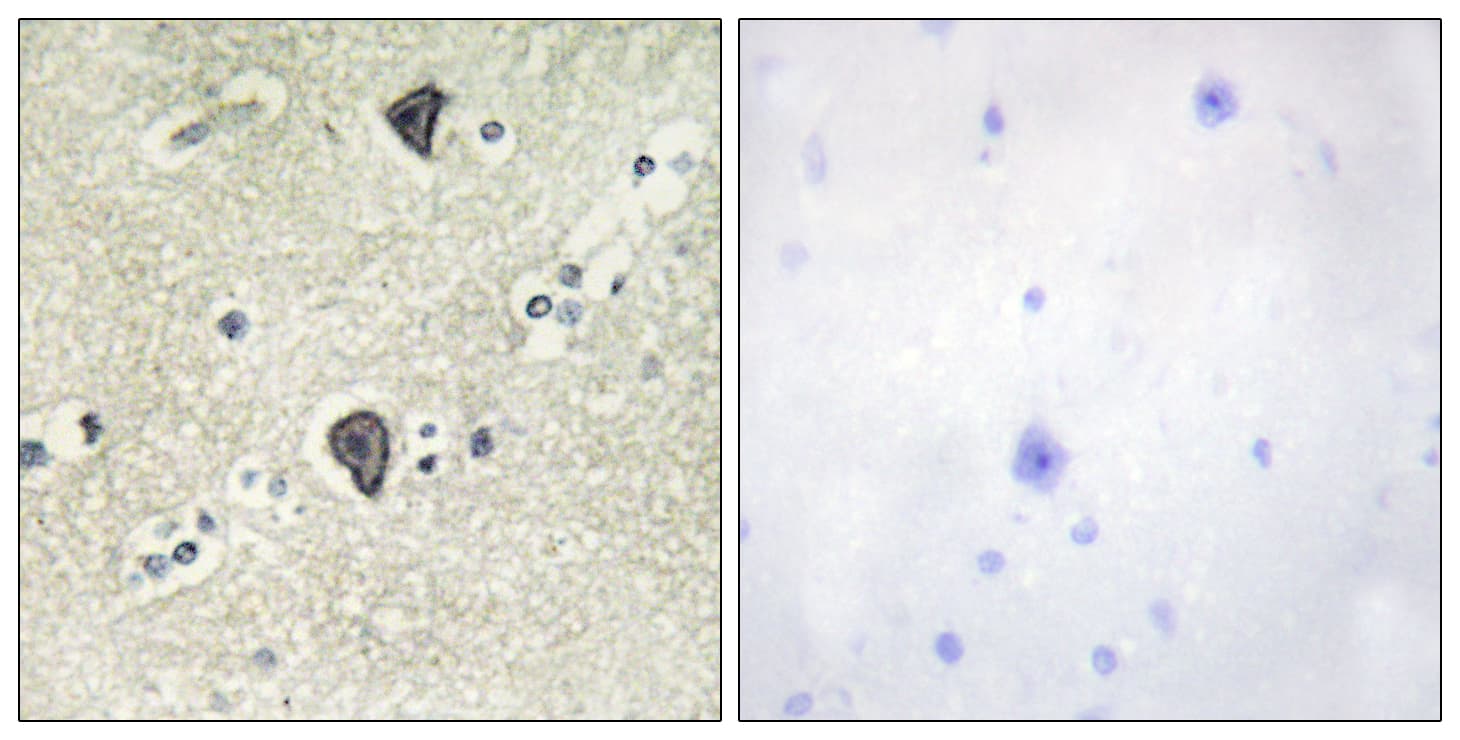 Polyclonal Rabbit anti-Human FGFR3 Antibody (aa131-180, IHC, WB)