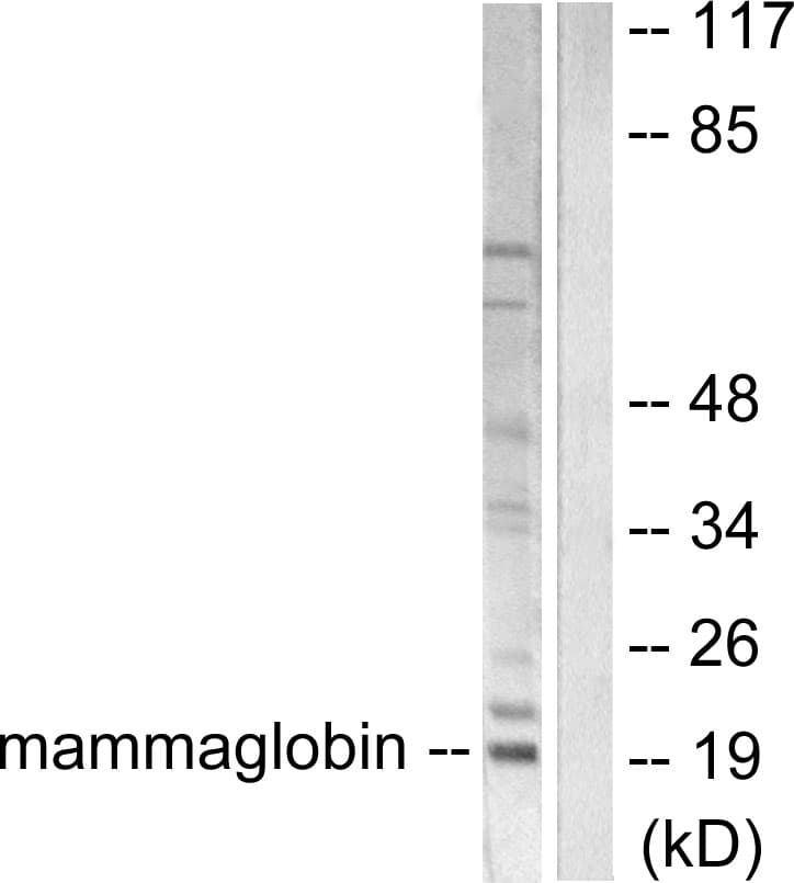 SCGB2A2 / Mammaglobin A Antibody (aa41-90)