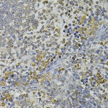 C/EBP Epsilon / CEBPE Antibody