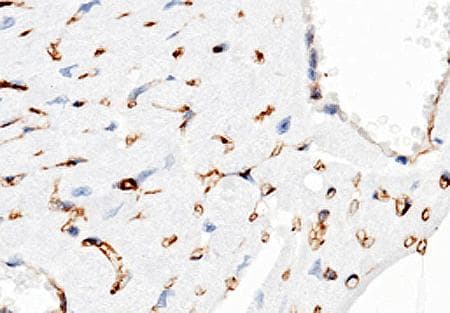 CD38 Antibody (clone 32, Preservative Free)