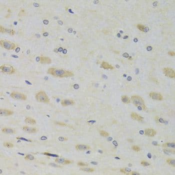 Polyclonal Rabbit anti-Human RPL9 / Ribosomal Protein L9 Antibody (IHC, IF, WB)
