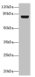 Polyclonal Rabbit anti-Human TSGA10 Antibody (IHC, WB)