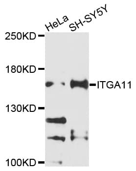 Polyclonal Rabbit anti-Human ITGA11 / Integrin Alpha 11 Antibody (WB)
