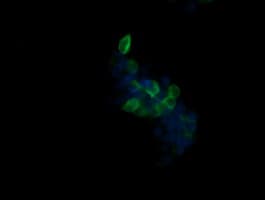 B3GNT2 Antibody (clone OTI3A9)