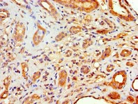 Polyclonal Rabbit anti-Human FLOT2 / Flotillin 2 Antibody (aa239-428, IHC, WB)