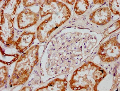 Polyclonal Rabbit anti-Human MT-CO2 Antibody (IHC, WB)