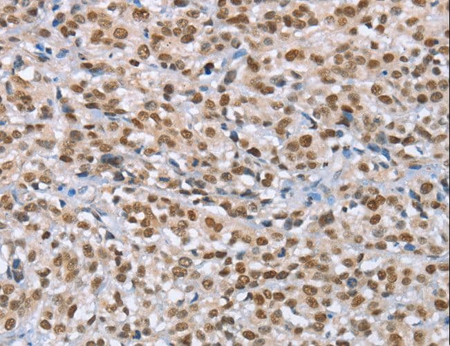 MCM6 Antibody