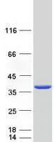 Human SRM / Spermidine Synthase Protein (Recombinant Myc-DDK (Flag))
