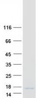 Human BLCAP Protein (Recombinant Myc-DDK (Flag))