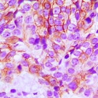 PathPlus™ CDH1 / E Cadherin Antibody (N-Terminus)
