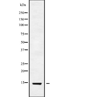 Polyclonal Rabbit anti-Human ATP6V1G3 Antibody (WB)