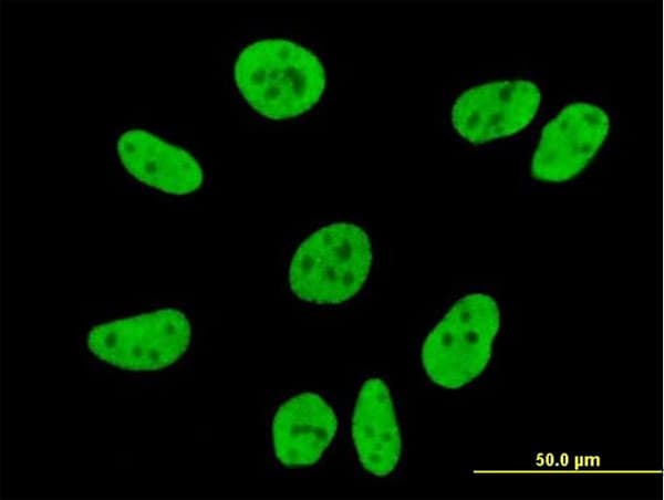 CCDC132 Antibody (clone 2D11)