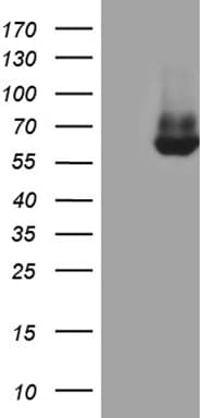 ESR2 / ER Beta Antibody (aa1-260, clone OTI1E12)