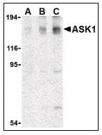 IHC-plus™ Polyclonal Rabbit anti-Human MAP3K5 / ASK1 Antibody (IHC, IF, WB)