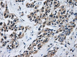 ACO2 / Aconitase 2 Antibody (clone OTI3G8)