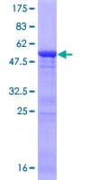 Human ING5 Protein (Recombinant GST)