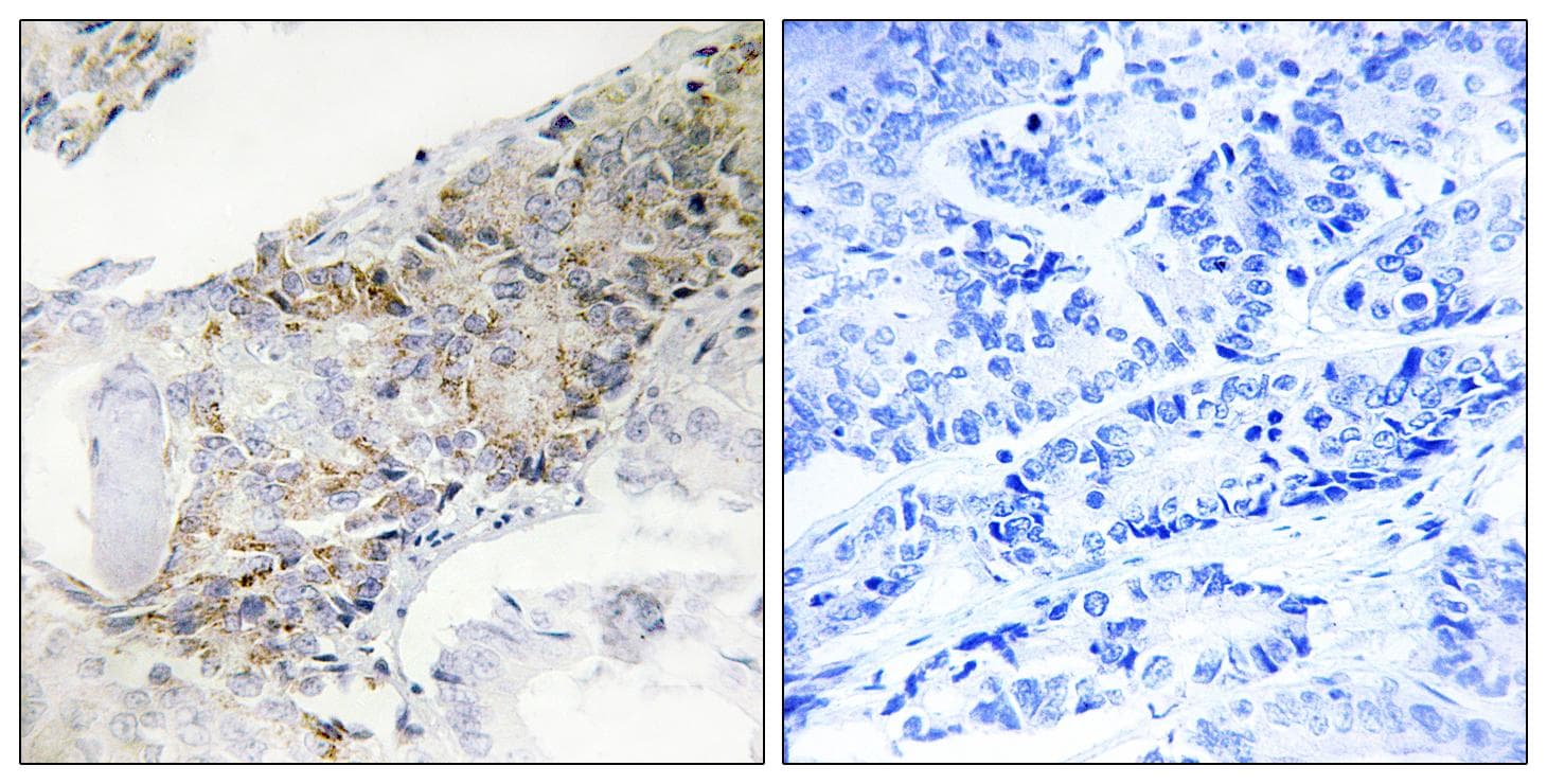 Polyclonal Rabbit anti-Human COX5B Antibody (IHC)