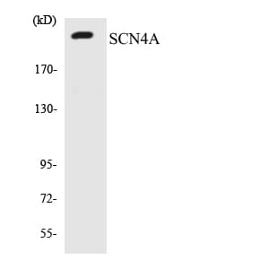 SCN4A / Nav1.4 Antibody (aa413-462)