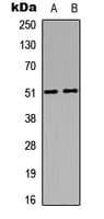 MKNK1 / MNK1 Antibody (Internal)
