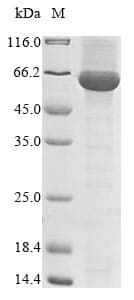 Polyprotein (Turnip mosaic virus) (Recombinant 10His, N-terminus + Myc, C-terminus)