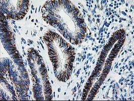SOCS3 Antibody (clone OTI8G3)