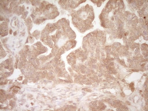HGF / Hepatocyte Growth Factor Antibody (aa200-494, clone OTI2F3)