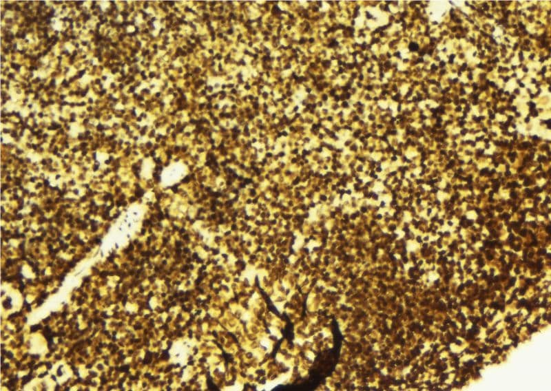 TRPS1 Antibody