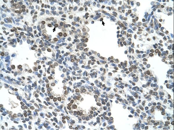 NKD1 Antibody (aa65-114)