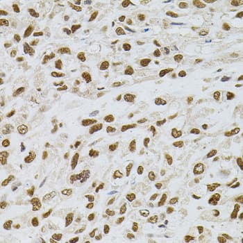 TGM2 / Transglutaminase 2 Antibody