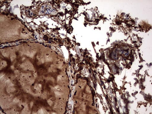 KRT7 / CK7 / Cytokeratin 7 Antibody (clone OTI2A2)