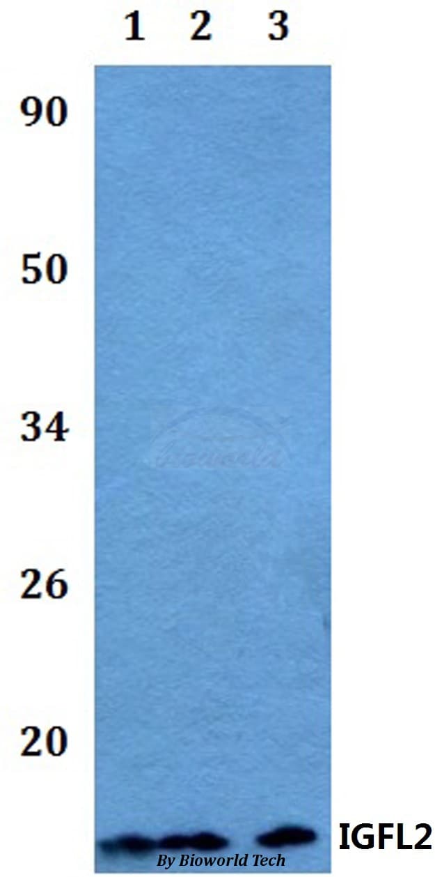 Polyclonal Rabbit anti-Human IGFL2 Antibody (WB)