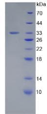 Human LAMC1 / Laminin Gamma 1 Protein (Recombinant His)