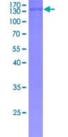 Human BACH2 Protein (Recombinant GST)