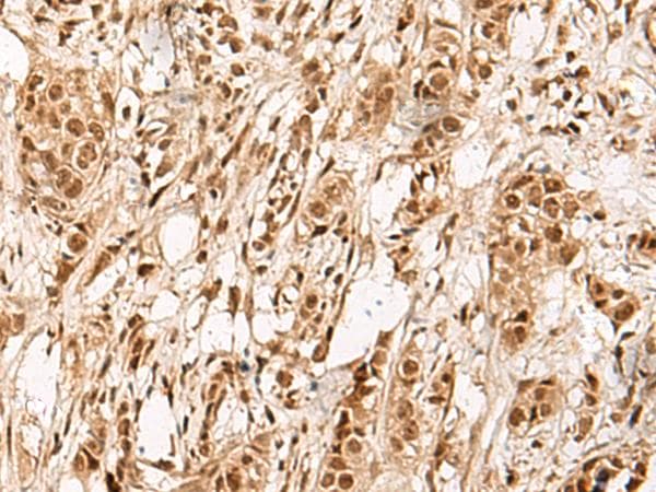 ZBTB43 Antibody