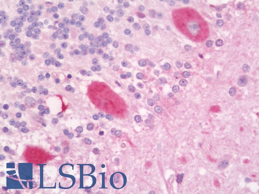 IHC-plus™ CORO1B Antibody (aa450-489)