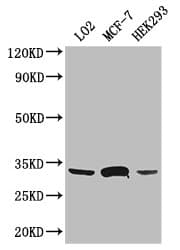 Polyclonal Rabbit anti-Human SLC25A6 / ANT3 Antibody (IHC, WB)
