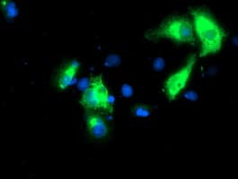 KCNJ3 / GIRK1 Antibody (clone OTI3E11)