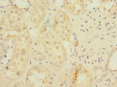 Polyclonal Rabbit anti-Human BDH2 Antibody (IHC)