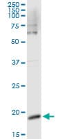 Monoclonal Mouse anti-Human CSF3 / G-CSF Antibody (clone 2C5)