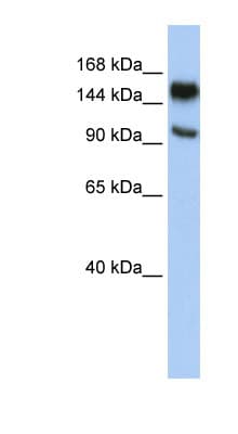 PARP10 Antibody (C-Terminus)